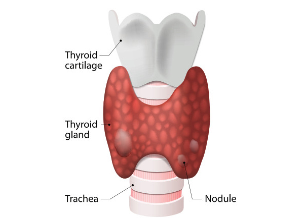 Thyroid